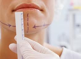 Rhinoplasty in Lisle, IL, Can Make You Feel Less Self-Conscious