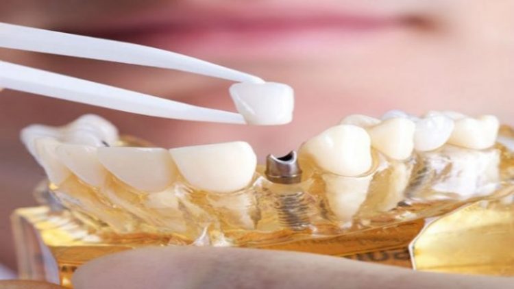 Complete Care for the Whole Family: Family Dentist in Davison, MI