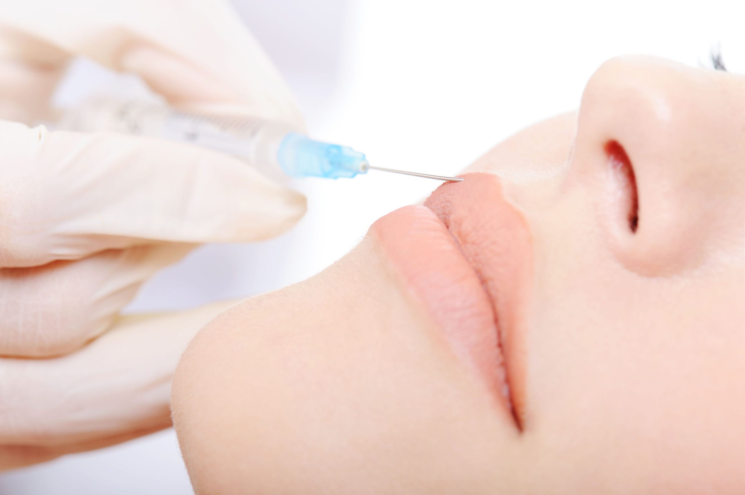 An Overview of Chicago Lip Fillers For Patients Who Need a Quick Summary