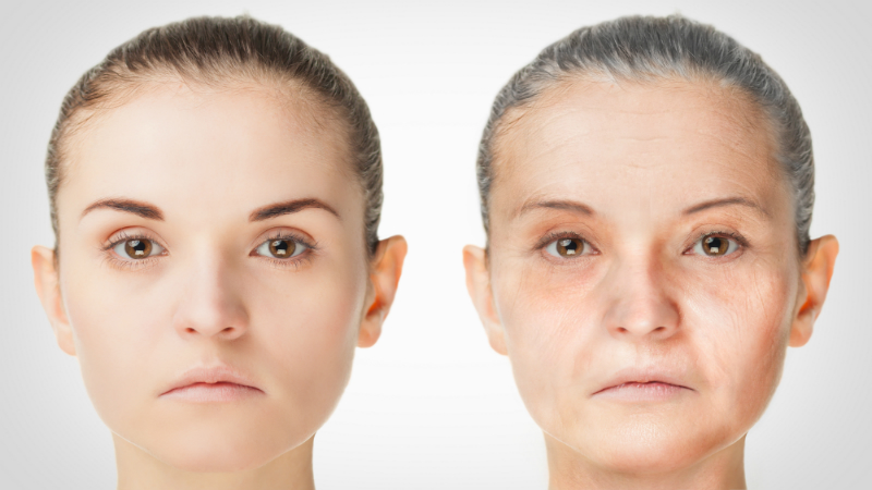 Things to Know When Considering a PDO Thread Cheek Lift in Chicago
