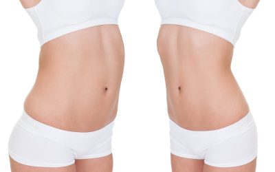 Contouring Your Body: The Appeal of Liposuction in Boston, MA