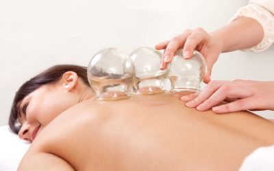 Experience Professional Cupping Therapy in Buffalo NY for Pain Relief