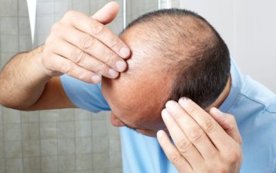 Real Success Stories Using Hair Loss Treatment Products Among US Users
