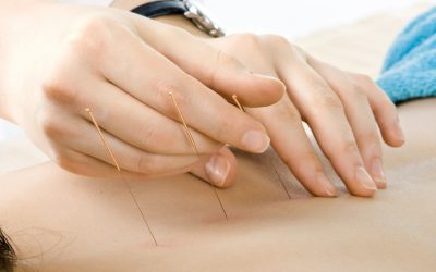 Experience Lasting Relief With Acupuncture For Pain Union City, CA Residents Trust