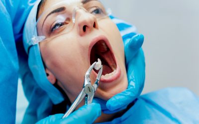 Fast Recovery Tips After Wisdom Tooth Removal Louisville Oral Surgeons Share